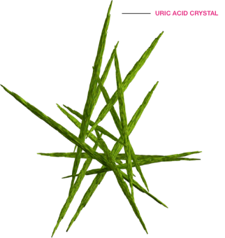 Uric acid crystal
