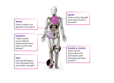 nph-skeleton_rheum-mobile
