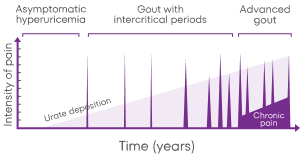 Time chart of gout progression from asymptomatic to advanced gout