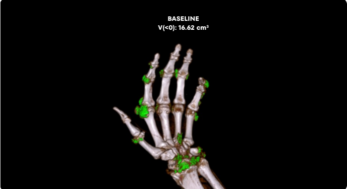 MIRROR RCT AT BASELINE